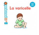 LA VARICELLE